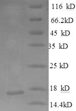 Human NFASC protein