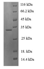 Human NGB protein