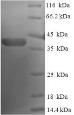Human NOL3 protein