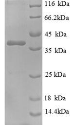 Human NPHP1 protein
