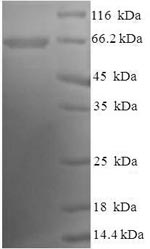 Human NPR2 protein