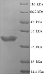 Human NTS protein