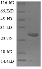 Human NUP153 protein