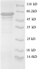 Human OGT protein