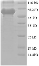Human OLA1 protein