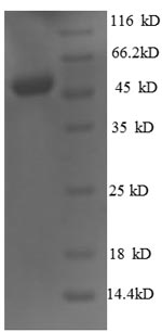 Human OTX2 protein