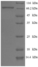 Human Parkin protein