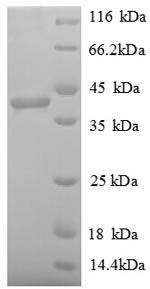 Human PARP11 protein