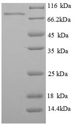 Human PCK1 PEPCK1 protein