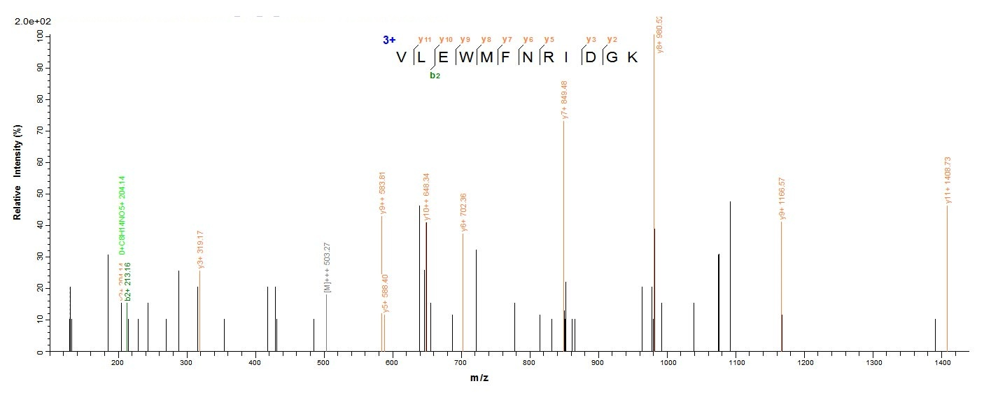 Human PCK1 PEPCK1 protein