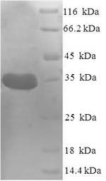 E.coli def protein
