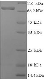 Human PGM3 protein