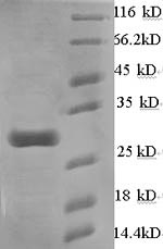 Mouse Pla2g5 protein