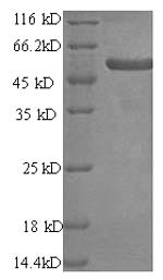 Human PRAME protein