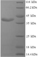 E.coli PR protein