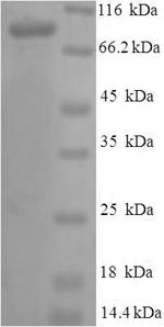 Human PROS1 protein