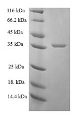 Human PSAP protein