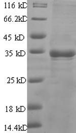 Human PSCA protein