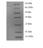 Human PTPN6 protein