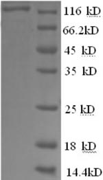 Human PYGL protein