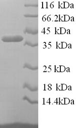 Human PZP protein