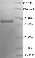 Human RAB5A protein