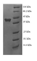 Human RBFOX2 protein