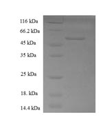 Human RDH11 protein