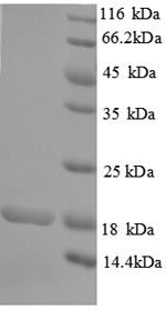 Human RHBDL2 protein