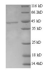 Human ROR1 protein