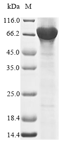 Human RORC protein