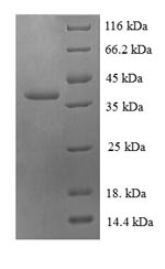 Human RPL30 protein