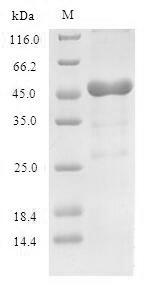 Human RPLP0 protein