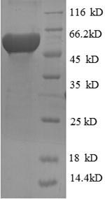 Human RRM2 protein
