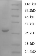 Human S100A11 protein
