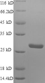 Human S100A4 protein