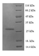 Human S100A6 protein
