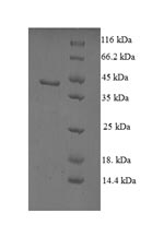 Human SCP2 protein