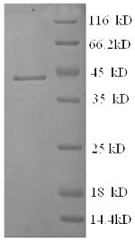 Human SERPINA6 protein