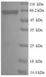 Rat Serpinb2 protein
