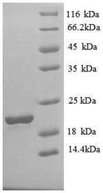 Human SLC41A2 protein