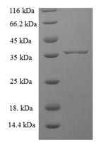 Human SNX24 protein