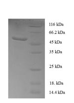 Human SOSTDC1 protein