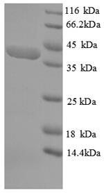 Human SPEG protein