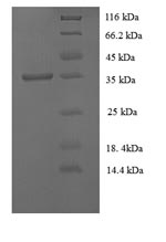 Rabbit TFPI protein