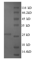 Bovine TIMP4 protein