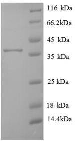 Human TMEM14B protein
