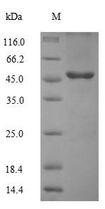Human TMEM25 protein