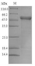 Human TMLHE protein