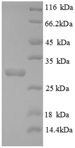 Mouse Tpsab1 protein